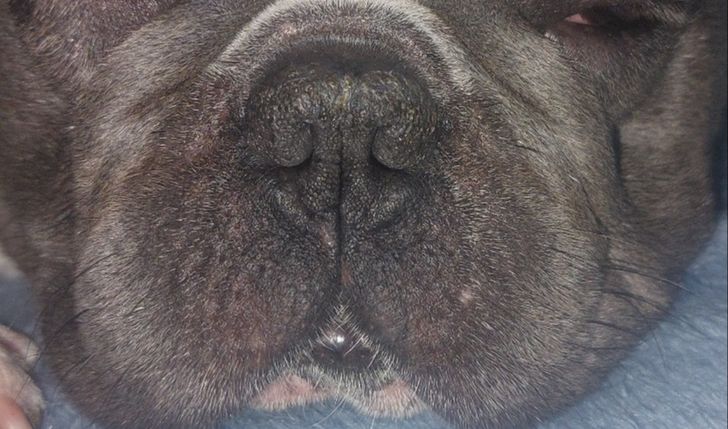 Operacja syndrom BOAS